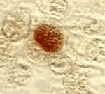 Bild: CDC/Dr. E. Arum/Dr. N. Jacobs