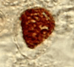 Bild: CDC/Dr. E. Arum/Dr. N. Jacobs